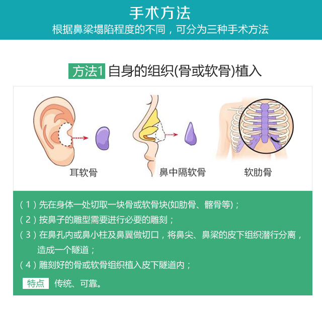 马鞍鼻