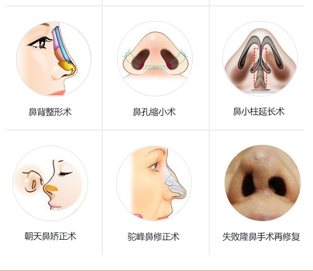 鼻综合百科