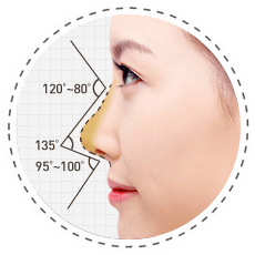 魏亨坤隐形隆鼻术结合鼻尖、鼻翼整形