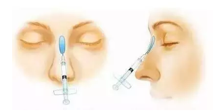 注射隆鼻模拟未意图