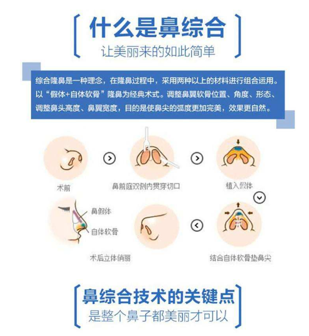 韩国will整形医院魏亨坤讲假体隆鼻与鼻综合该怎么选择