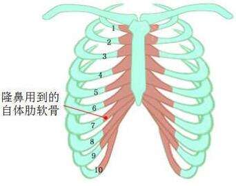 肋软骨取自6到7之间